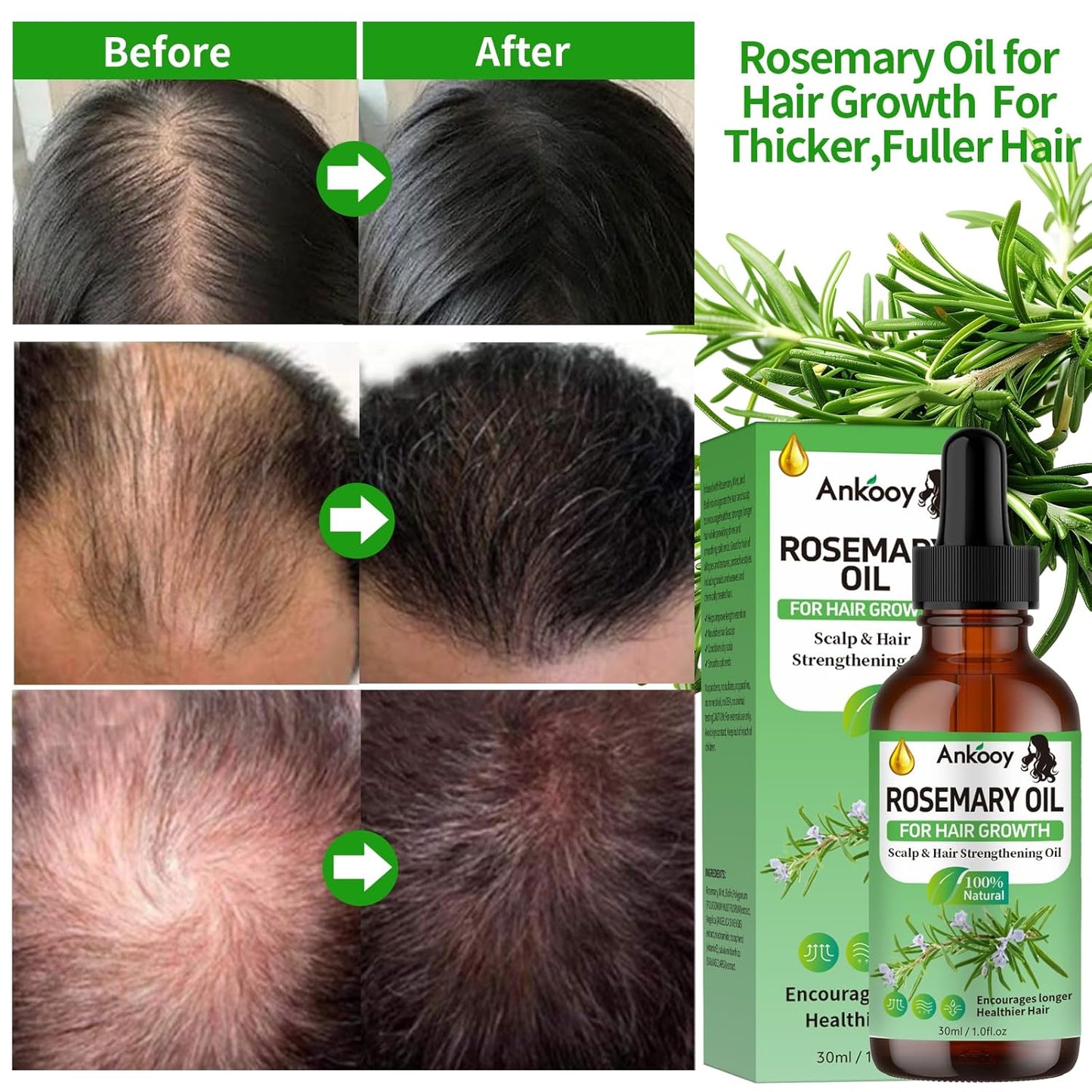 3 Pack Rosemary Oil, Hair Strengthening Care Promotes Hair Thickness for Men Women - BigGreenBear.com Beauty Products 15.25 USD Big Green Bear