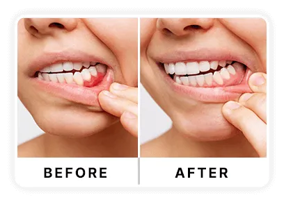 DentaVive Review: Real Results Review: Buy or No Buy Biggreenbear.com